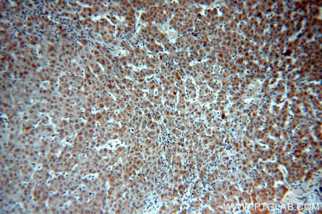 SULT1A3 Antibody in Immunohistochemistry (Paraffin) (IHC (P))