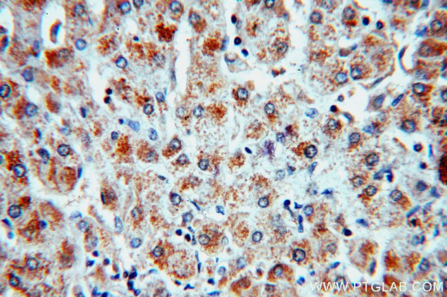 SULT1A3 Antibody in Immunohistochemistry (Paraffin) (IHC (P))