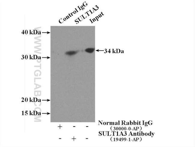 SULT1A3 Antibody in Immunoprecipitation (IP)