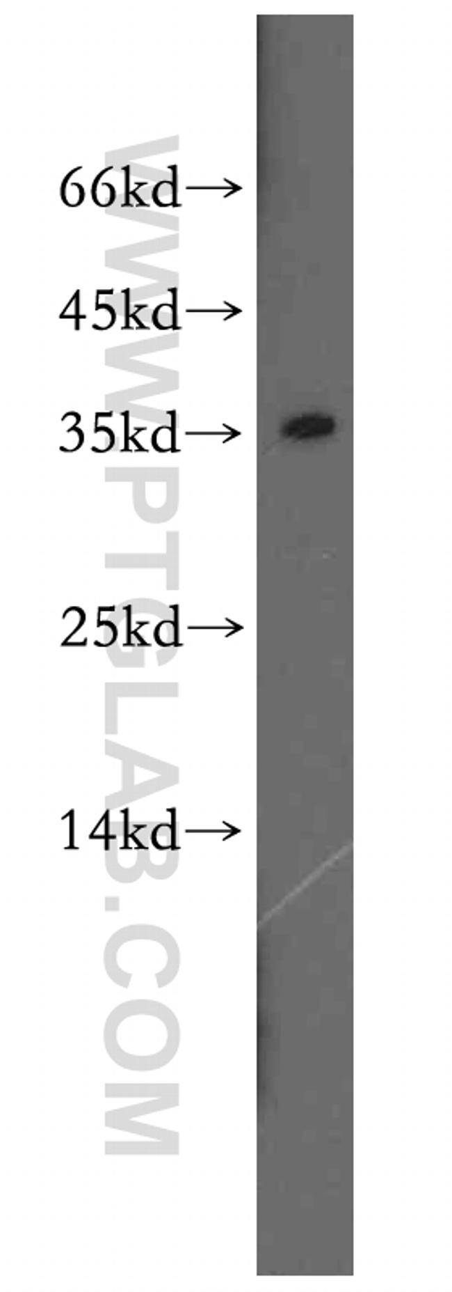 SULT1A3 Antibody in Western Blot (WB)