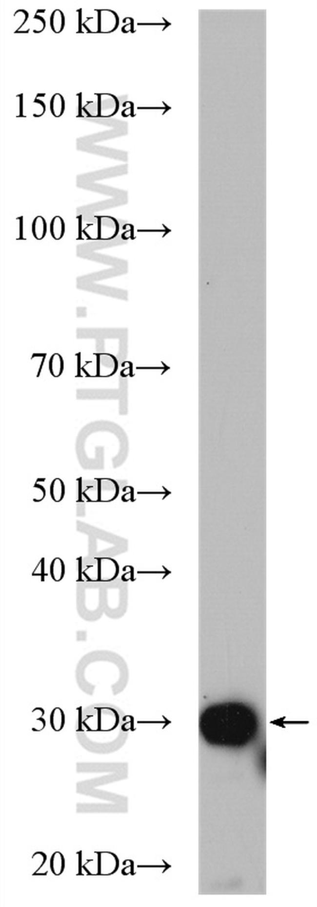 SULT1A3 Antibody in Western Blot (WB)