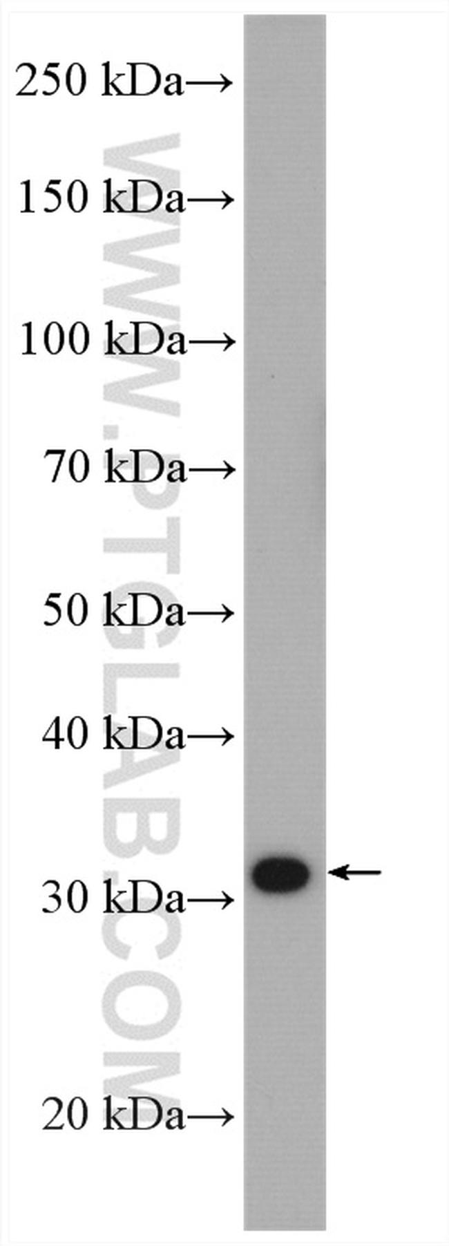 SULT1A3 Antibody in Western Blot (WB)