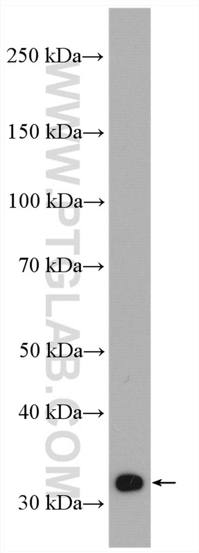 SULT1A3 Antibody in Western Blot (WB)