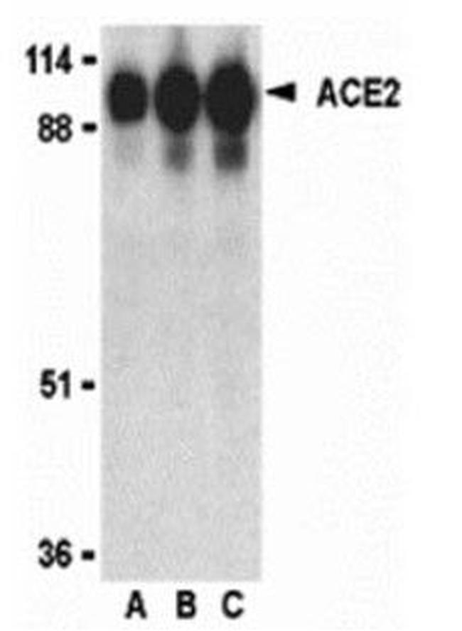 Angiotensin Converting Enzyme 2 (ACE2) Antibody in Western Blot (WB)