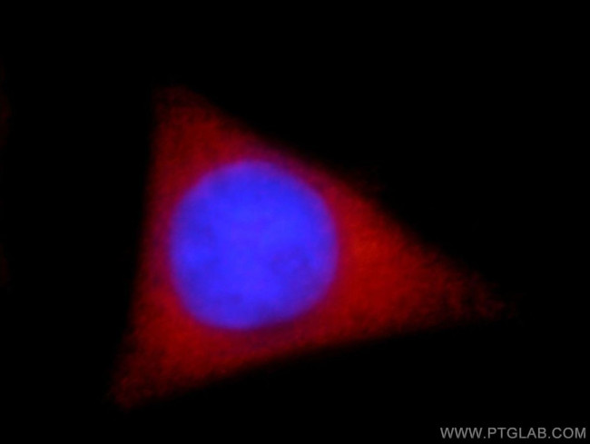 MAST3 Antibody in Immunocytochemistry (ICC/IF)