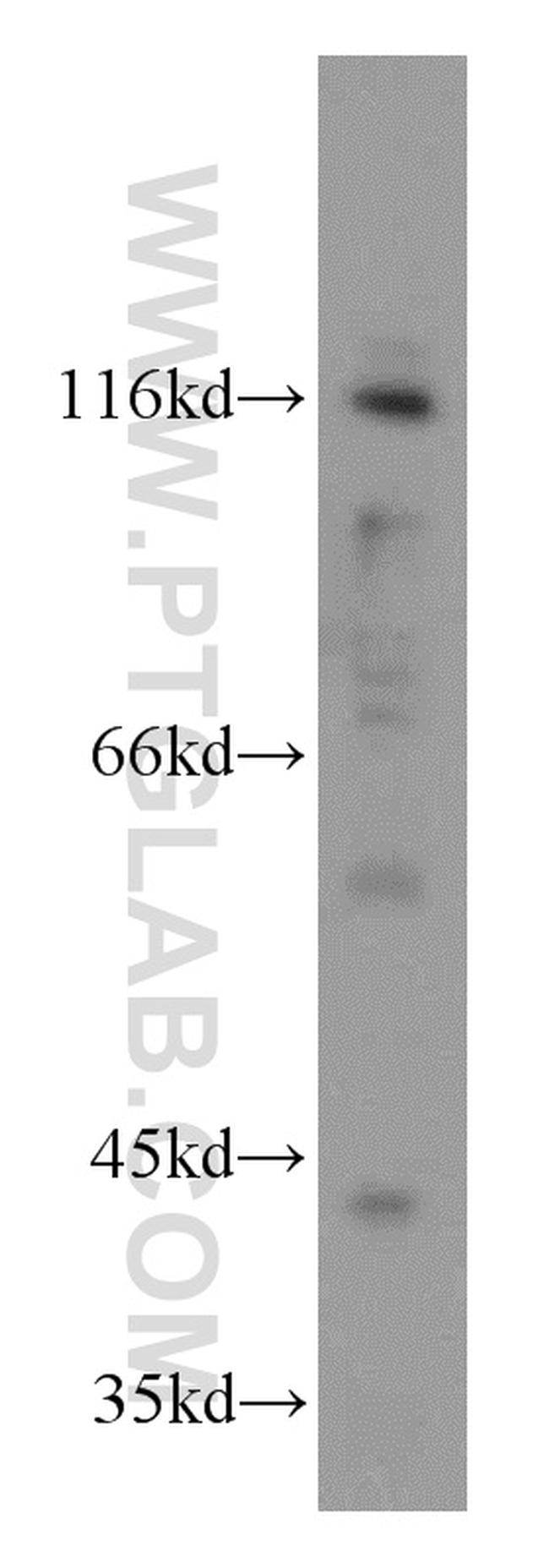 PACS2 Antibody in Western Blot (WB)