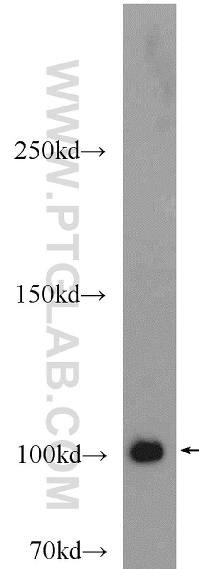 PACS2 Antibody in Western Blot (WB)