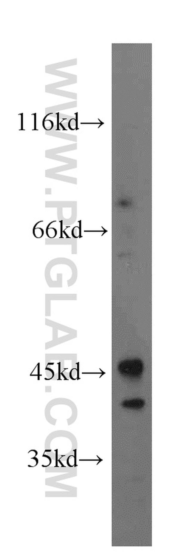 EDG7 Antibody in Western Blot (WB)