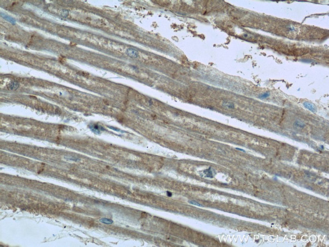 EDG7 Antibody in Immunohistochemistry (Paraffin) (IHC (P))