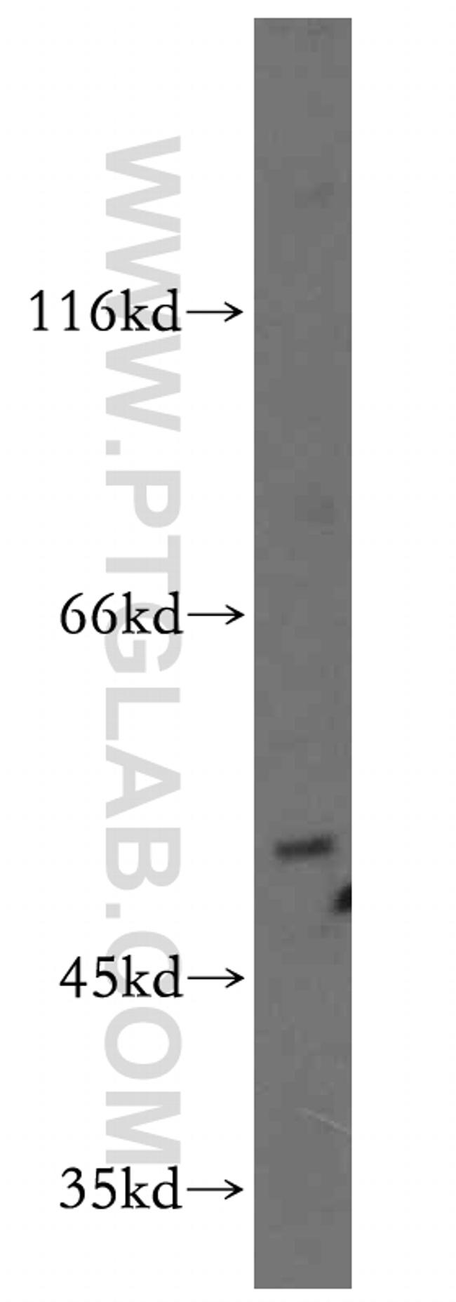 EDG7 Antibody in Western Blot (WB)