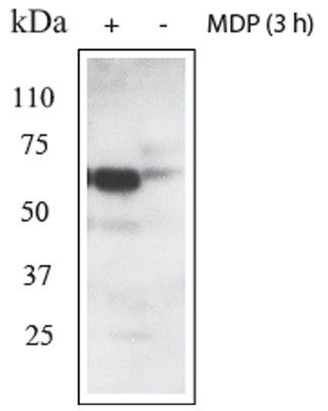 RIPK2 Antibody in Western Blot (WB)