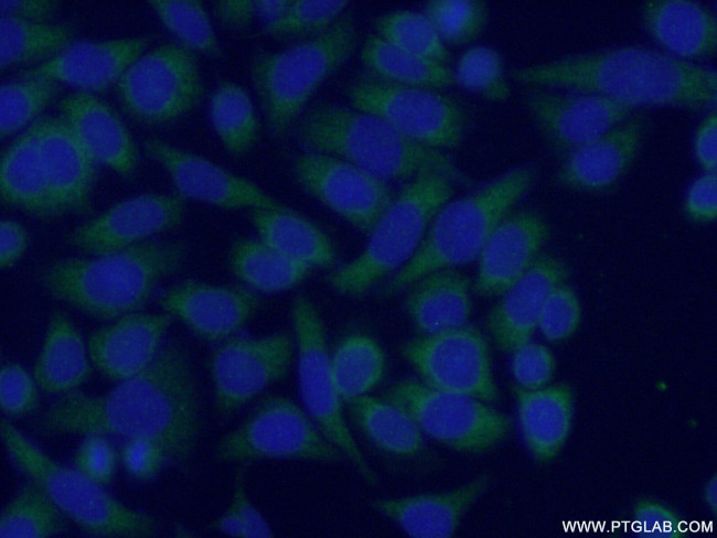 MRAP Antibody in Immunocytochemistry (ICC/IF)