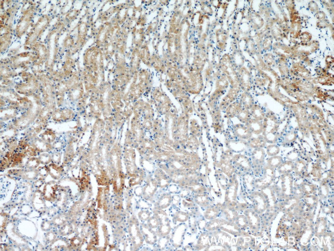 MRAP Antibody in Immunohistochemistry (Paraffin) (IHC (P))