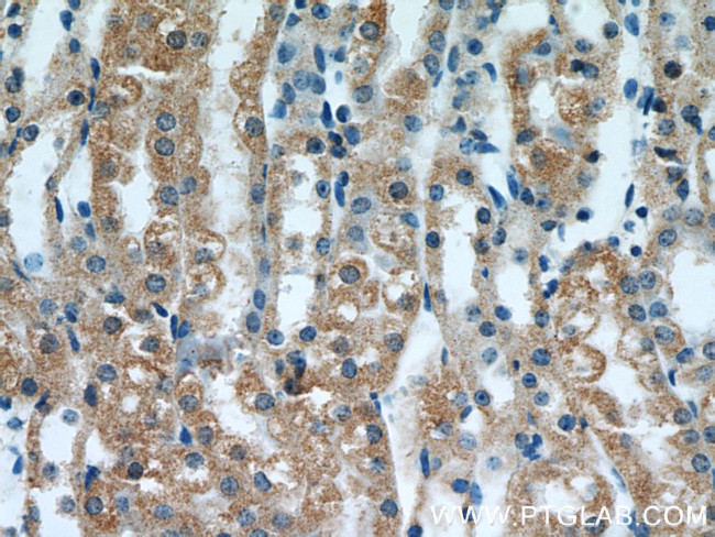 MRAP Antibody in Immunohistochemistry (Paraffin) (IHC (P))