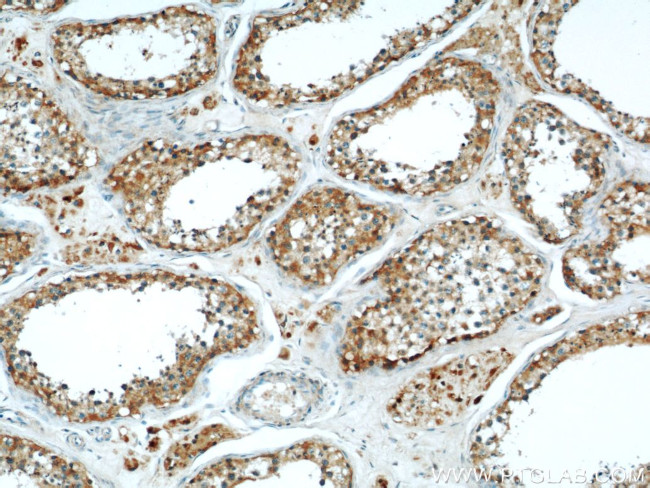 MRAP Antibody in Immunohistochemistry (Paraffin) (IHC (P))