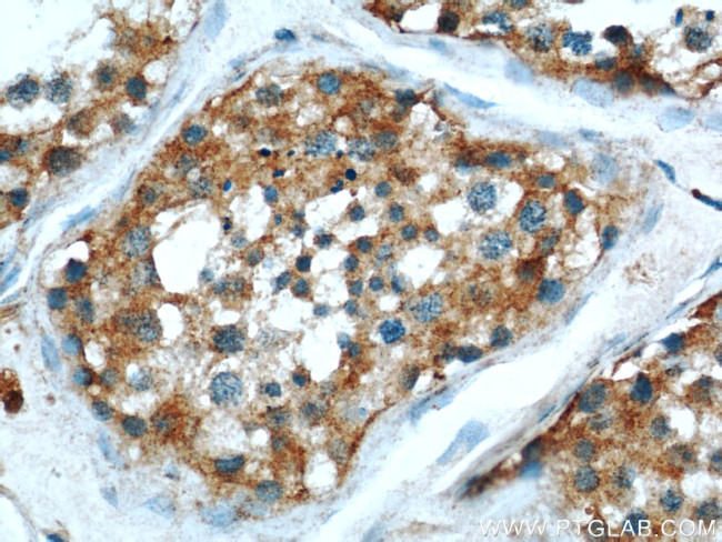 MRAP Antibody in Immunohistochemistry (Paraffin) (IHC (P))