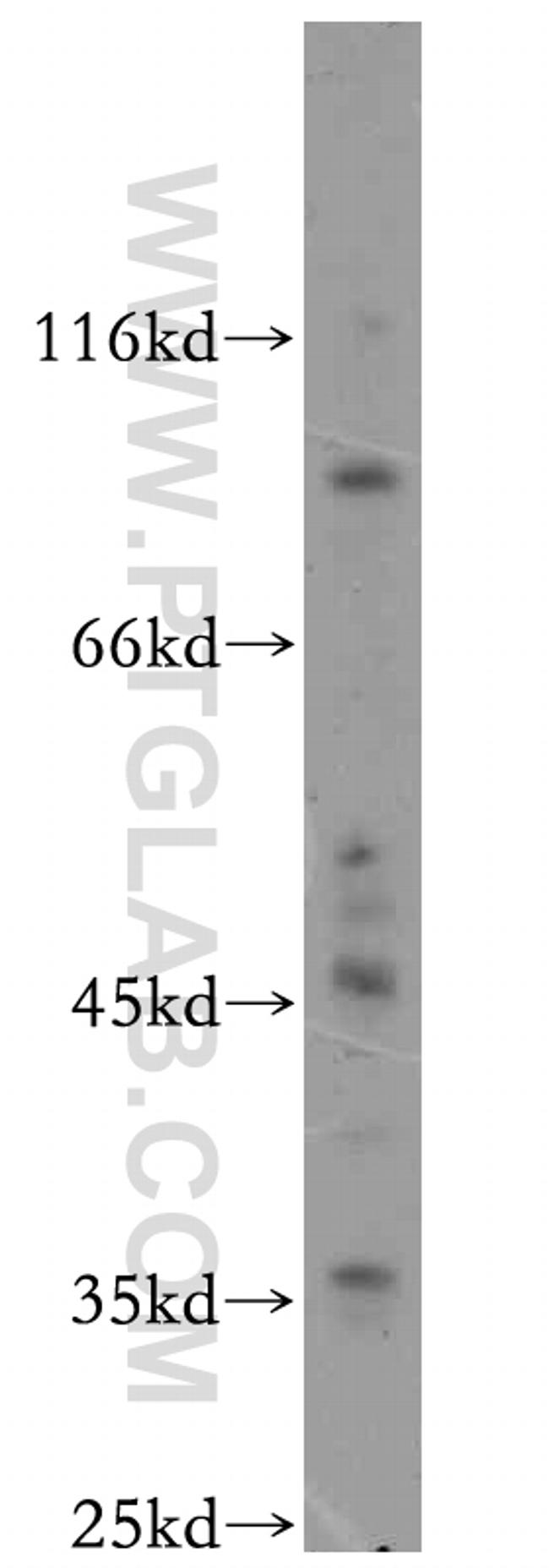 MOGAT2 Antibody in Western Blot (WB)