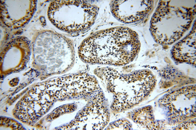 TXNRD3 Antibody in Immunohistochemistry (Paraffin) (IHC (P))