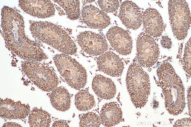 TXNRD3 Antibody in Immunohistochemistry (Paraffin) (IHC (P))