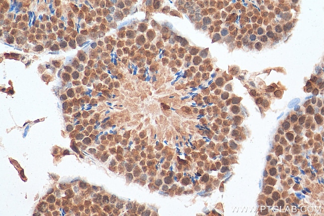 TXNRD3 Antibody in Immunohistochemistry (Paraffin) (IHC (P))