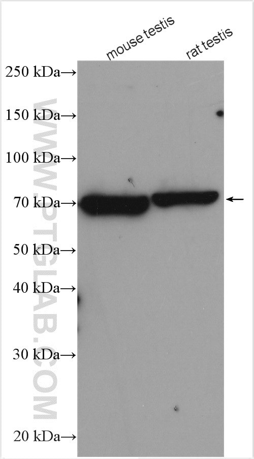 TXNRD3 Antibody in Western Blot (WB)