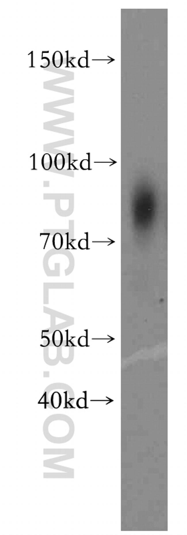 TXNRD3 Antibody in Western Blot (WB)