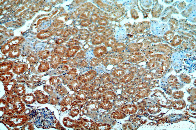 ATP6V1G3 Antibody in Immunohistochemistry (Paraffin) (IHC (P))