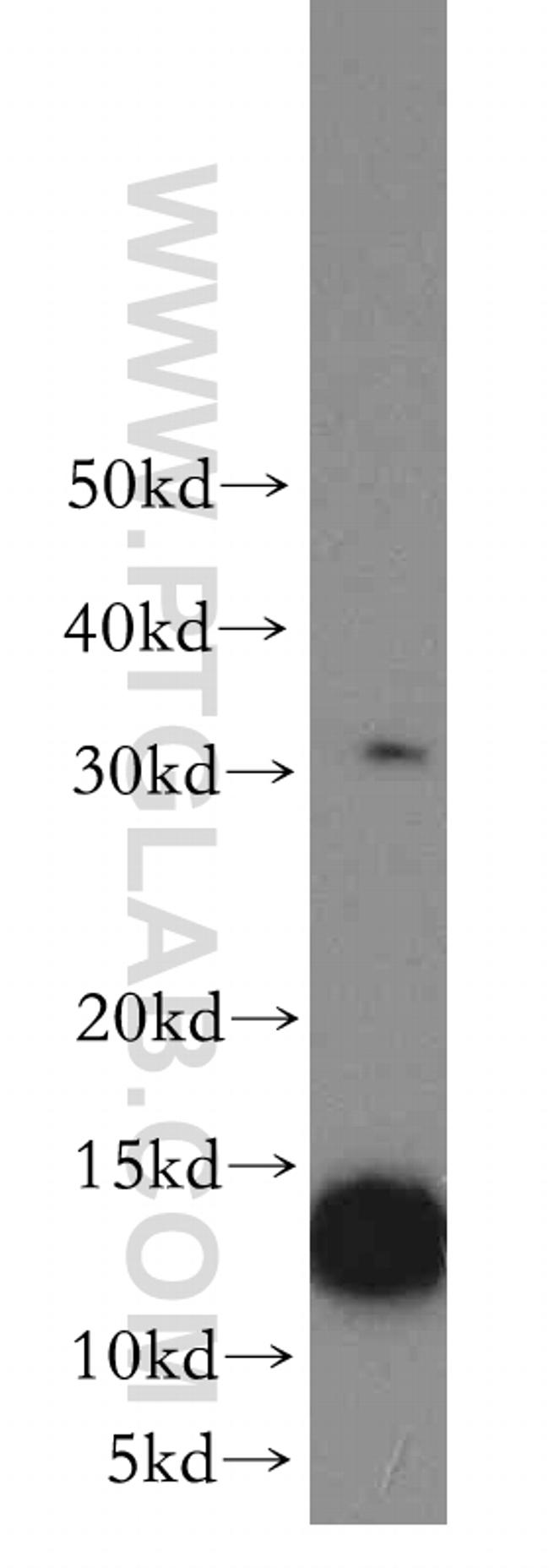 ATP6V1G3 Antibody in Western Blot (WB)