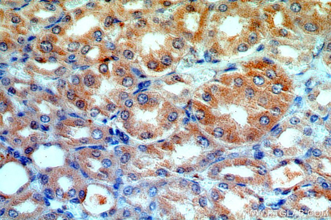 ATP6V1G3 Antibody in Immunohistochemistry (Paraffin) (IHC (P))