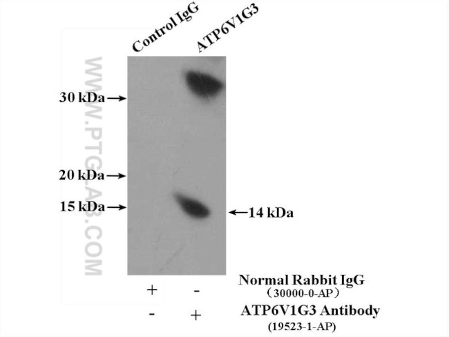 ATP6V1G3 Antibody in Immunoprecipitation (IP)