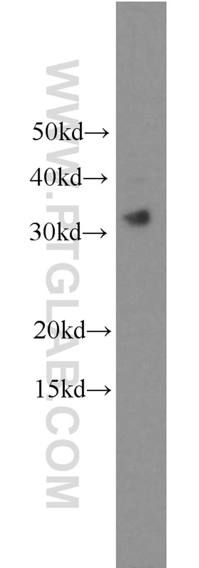 TICAM2 Antibody in Western Blot (WB)