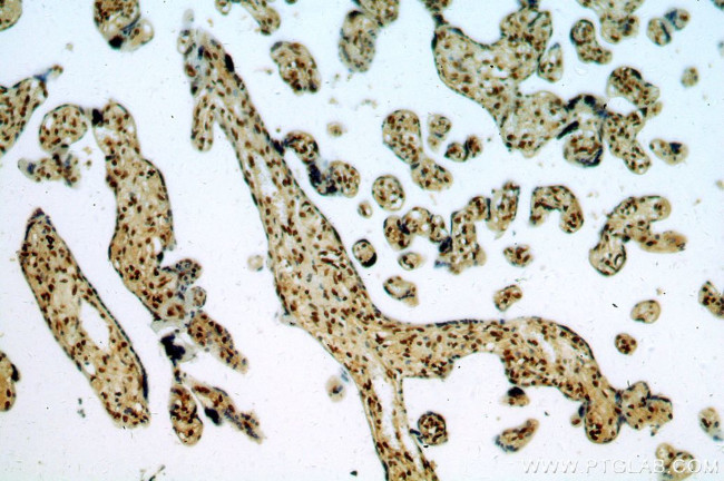 SENP5 Antibody in Immunohistochemistry (Paraffin) (IHC (P))