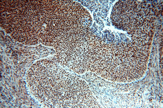 SENP5 Antibody in Immunohistochemistry (Paraffin) (IHC (P))