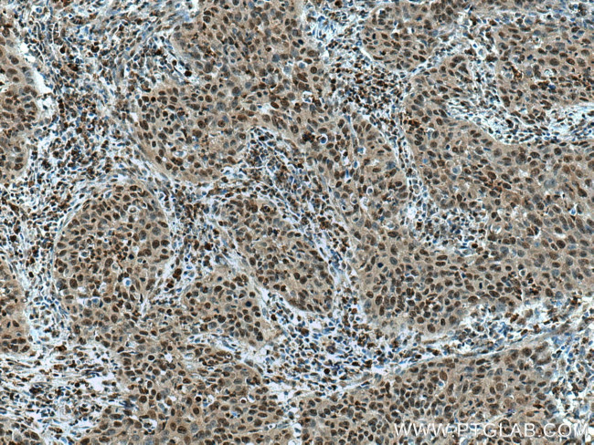 SENP5 Antibody in Immunohistochemistry (Paraffin) (IHC (P))