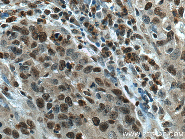 SENP5 Antibody in Immunohistochemistry (Paraffin) (IHC (P))