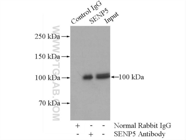 SENP5 Antibody in Immunoprecipitation (IP)