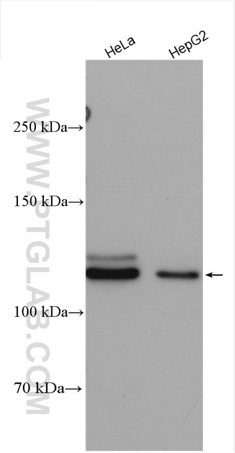 SENP5 Antibody in Western Blot (WB)