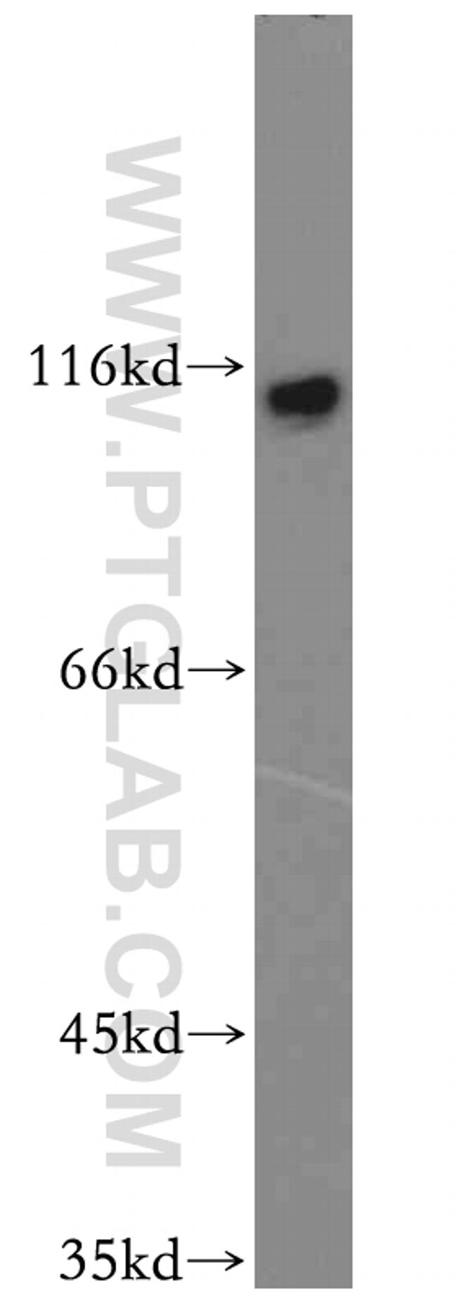 SENP5 Antibody in Western Blot (WB)