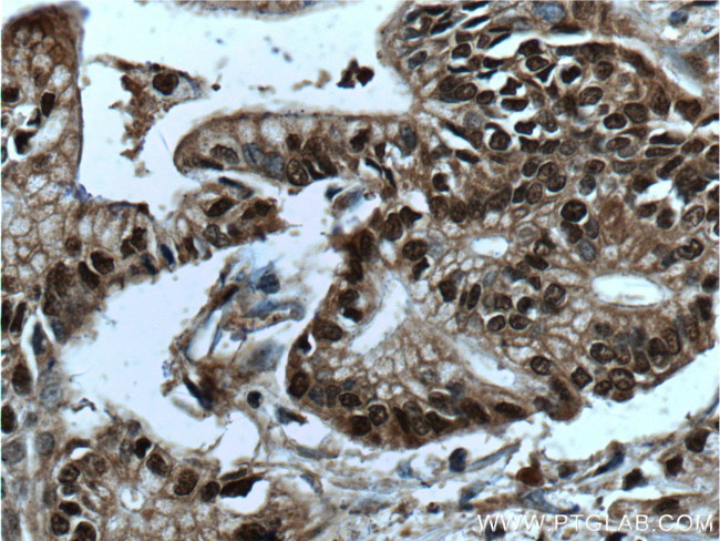 GATA4 Antibody in Immunohistochemistry (Paraffin) (IHC (P))