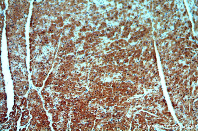 GATA4 Antibody in Immunohistochemistry (Paraffin) (IHC (P))