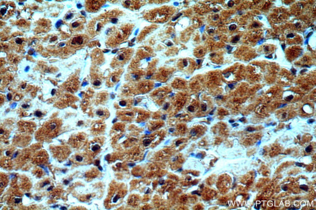 GATA4 Antibody in Immunohistochemistry (Paraffin) (IHC (P))