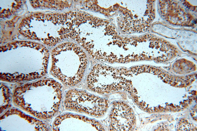 GATA4 Antibody in Immunohistochemistry (Paraffin) (IHC (P))