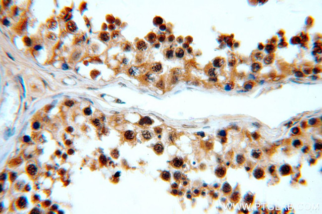 GATA4 Antibody in Immunohistochemistry (Paraffin) (IHC (P))