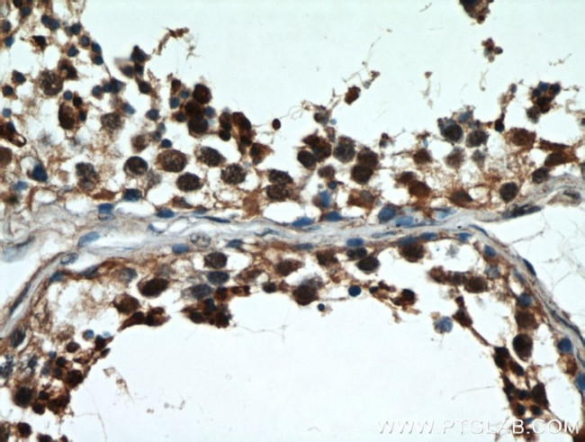 GATA4 Antibody in Immunohistochemistry (Paraffin) (IHC (P))