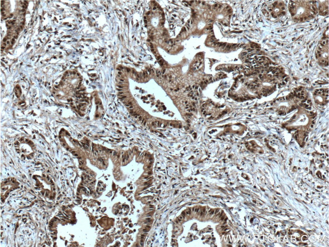 GATA4 Antibody in Immunohistochemistry (Paraffin) (IHC (P))