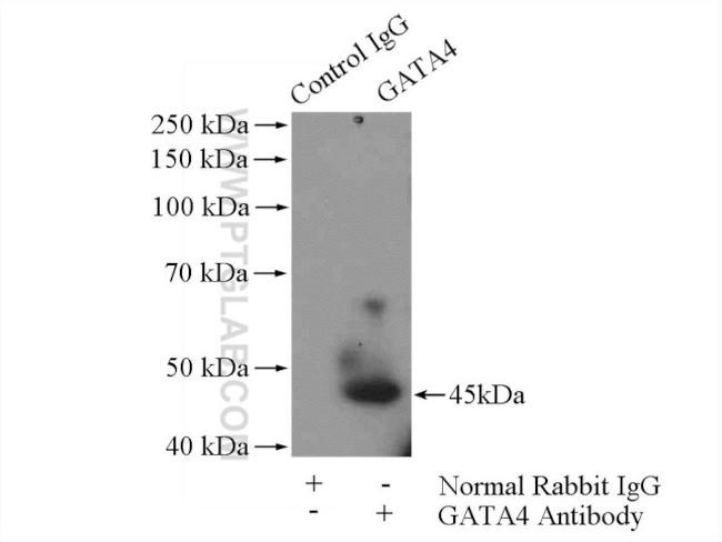 GATA4 Antibody in Immunoprecipitation (IP)