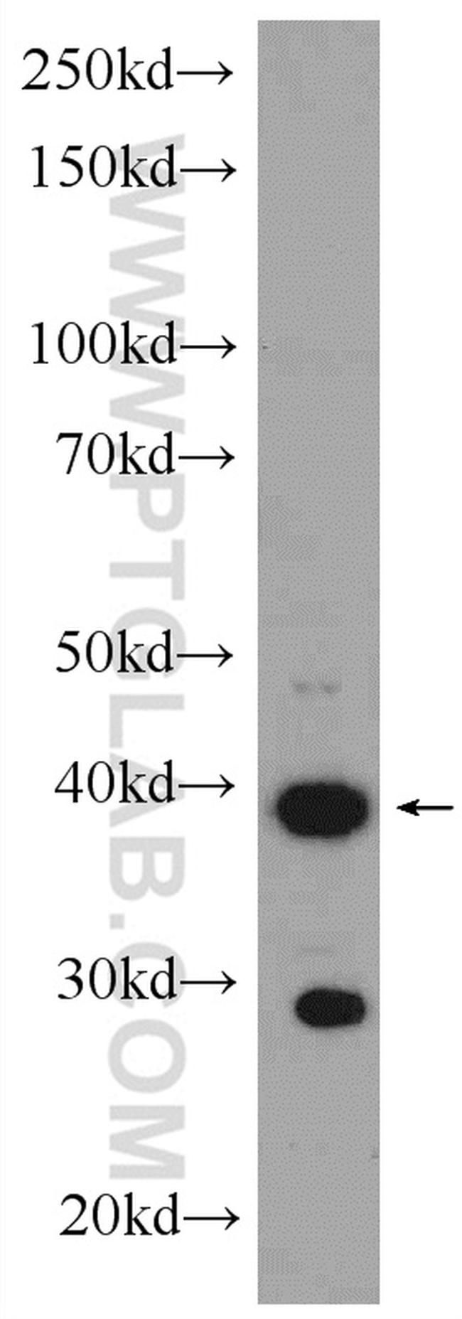 GATA4 Antibody in Western Blot (WB)