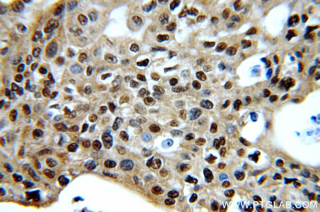 CDK1 Antibody in Immunohistochemistry (Paraffin) (IHC (P))