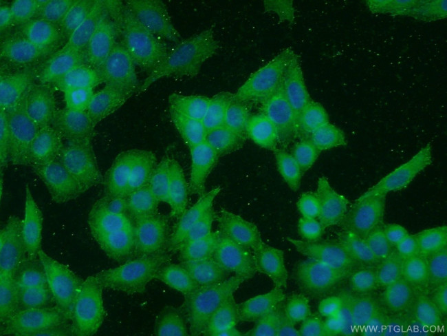 CDK1 Antibody in Immunocytochemistry (ICC/IF)