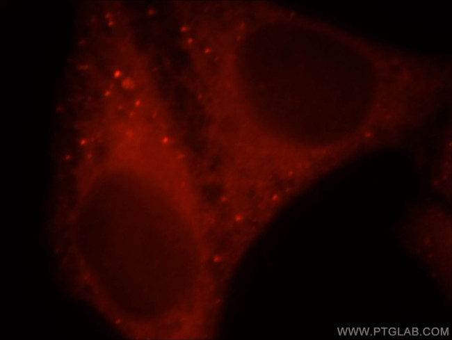 CHKA Antibody in Immunocytochemistry (ICC/IF)